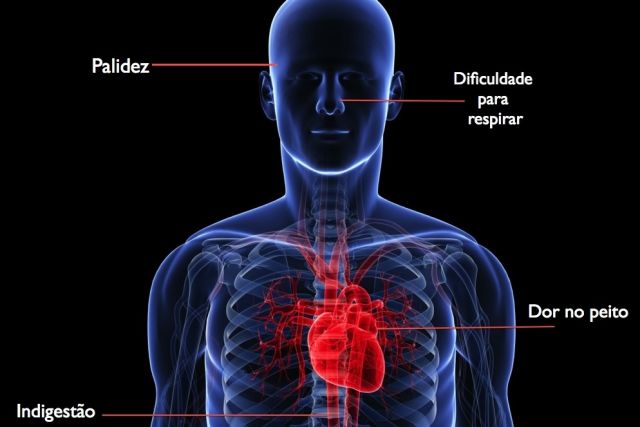 Infarto Agudo Do Mioc Rdio Cliquefarma