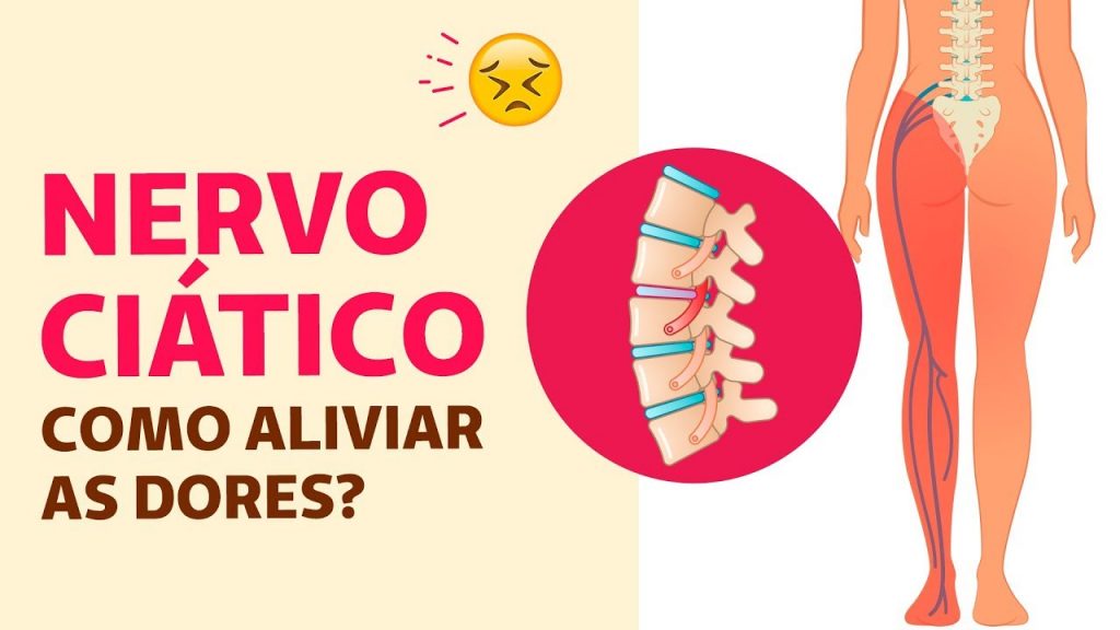 Nervo Ciático Sintomas E Tratamentos Cliquefarma 1166