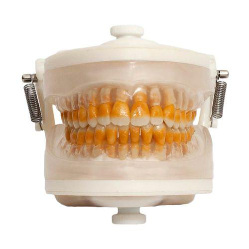 Manequim De Periodontia Pd 102 Pronew