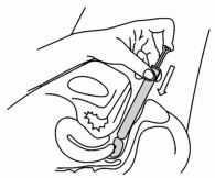 Imagem Complementar da Bula do Gyno - Icaden 600mg 1 ovulo