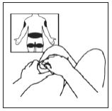 Imagem Complementar da Bula do lupron - depot pó injetável 11,25mg e 1 ampola de diluente e 1 seringa e 2 agulhas uso restrito a hospitais