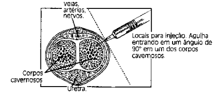 Imagem Complementar da Bula do Caverject - 20mcg C 1 Ampola E Seringa De 1ml, 2 Agulhas Estéreis E 2 Compressas Antissépticas Refrigerado