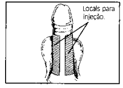 Imagem Complementar da Bula do Caverject - 20mcg C 1 Ampola E Seringa De 1ml, 2 Agulhas Estéreis E 2 Compressas Antissépticas Refrigerado