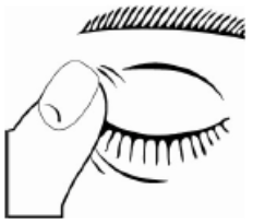 Imagem Complementar da Bula do Cloridrato - De dorzolamida e maleato timolol 20mg 5mg colírio c 5ml- ems genérico