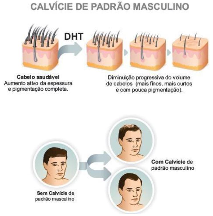 Imagem Complementar da Bula do Finalop - 1mg 30 comprimidos