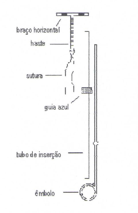 Imagem Complementar da Bula do diu de cobre cepeó tcu 380a com 1 unidade